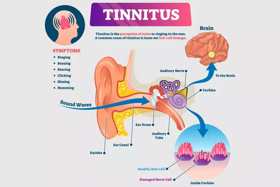 can an audiologist diagnose tinnitus